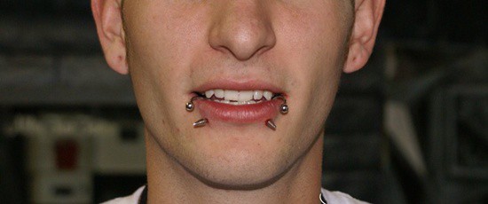 perforación del labio (19)