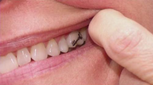 tatuaje de llave en el diente