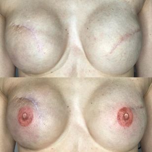 Tatuaje de mastectomía por Evie Bacopulos #EvieBacopulos #mastectomytattoo #mastectomyscarcoveruptattoo #scarcoveruptattoo #nippletattoo #mastectomy