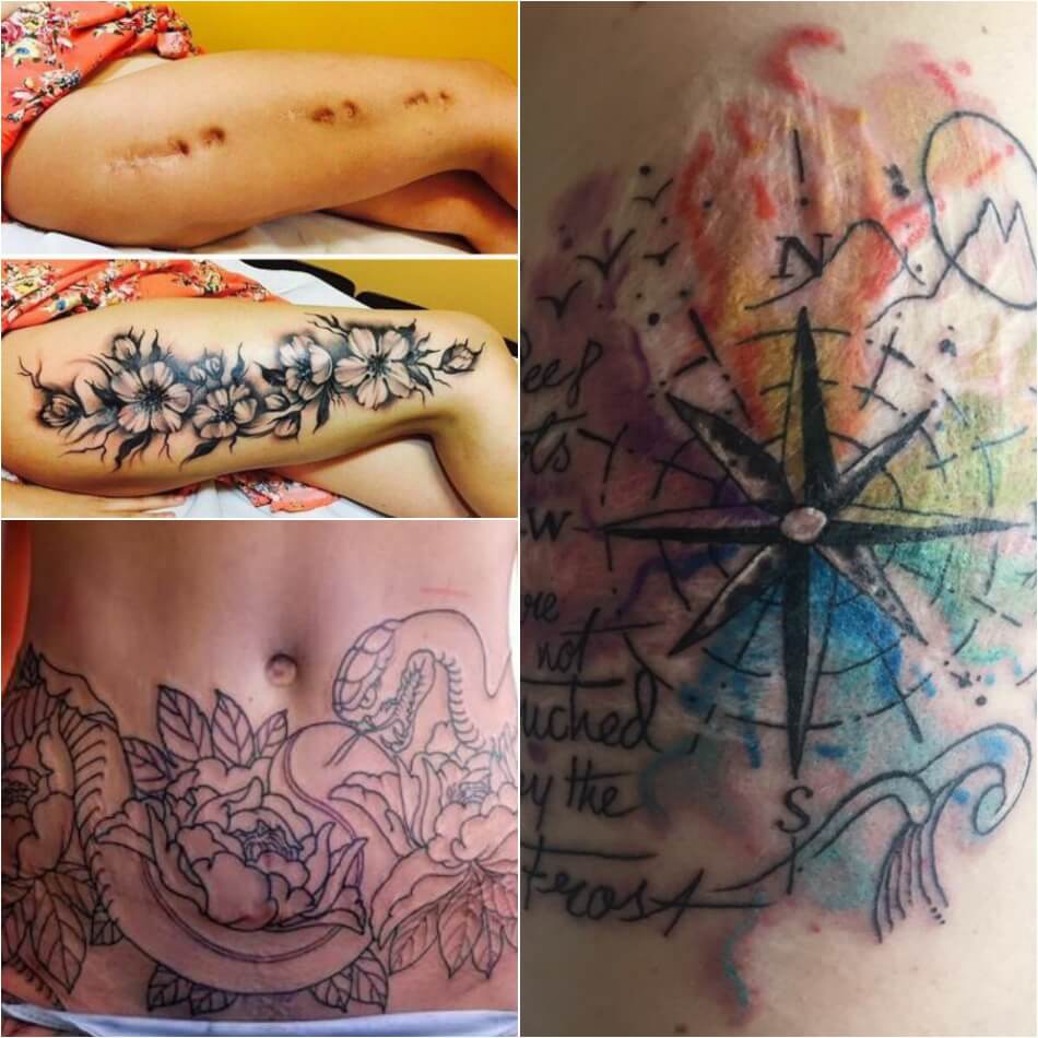 Tatuajes De Cicatriz - Tatuajes De Cicatriz - Tatuajes De Cicatriz - Cubierta De Cicatriz 